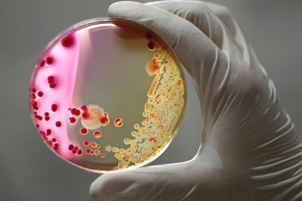 What are Bacterial Infections?