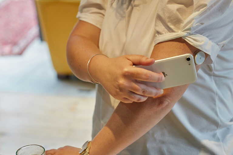 A South African woman with Type 1 diabetes scanning blood glucose with a flash glucose monitor.