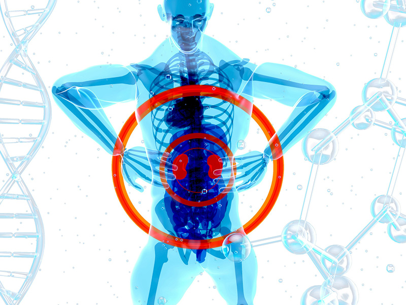X-ray of a person with kidney discharge