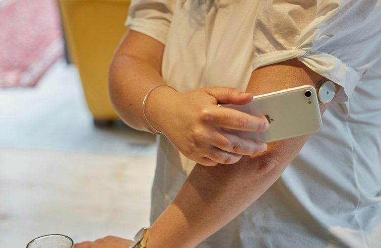 A South African woman with Type 1 diabetes scanning blood glucose with a flash glucose monitor.